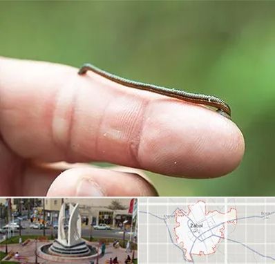 مرکز زالو درمانی در زابل