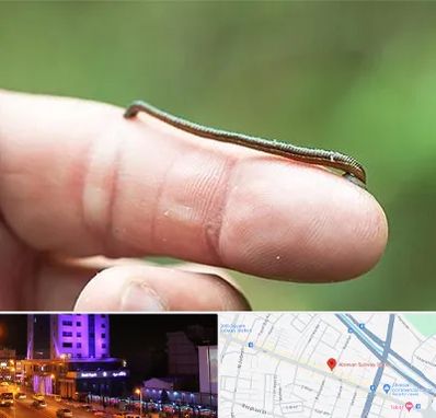 مرکز زالو درمانی در آبرسان تبریز