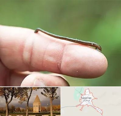مرکز زالو درمانی در تویسرکان