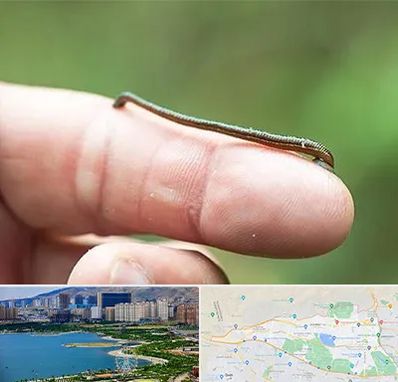 مرکز زالو درمانی در منطقه 22 تهران