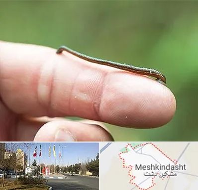 مرکز زالو درمانی در مشکین دشت