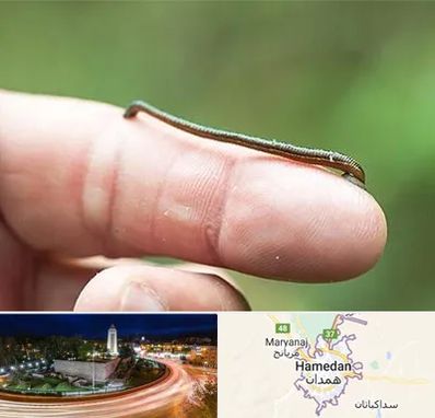 مرکز زالو درمانی در همدان