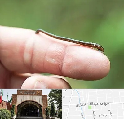 مرکز زالو درمانی در خواجه عبدالله