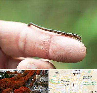 مرکز زالو درمانی در ولیعصر