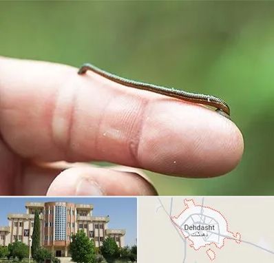 مرکز زالو درمانی در دهدشت