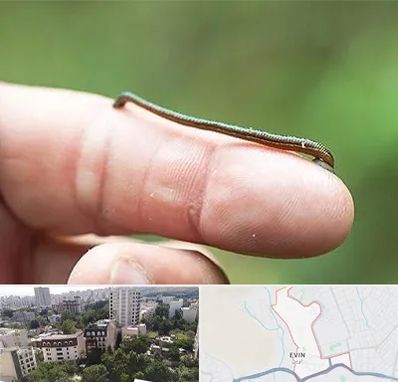 مرکز زالو درمانی در اوین