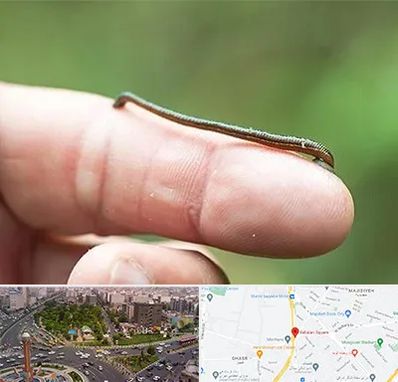 مرکز زالو درمانی در سبلان