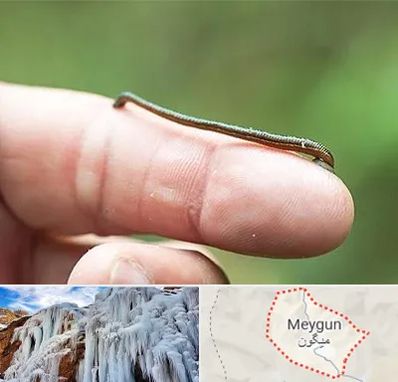 مرکز زالو درمانی در میگون