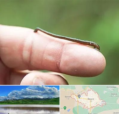 مرکز زالو درمانی در مرند