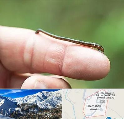 مرکز زالو درمانی در شمشک