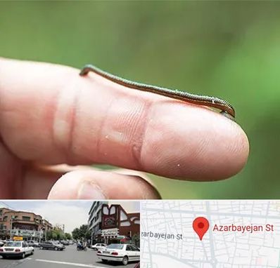 مرکز زالو درمانی در خیابان آذربایجان