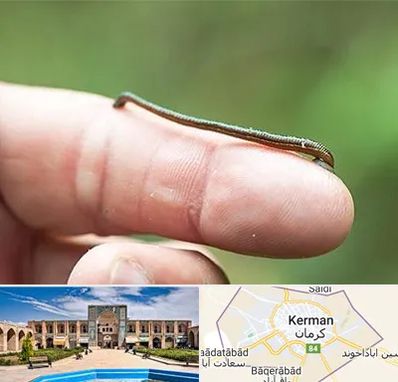 مرکز زالو درمانی در کرمان