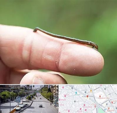 مرکز زالو درمانی در خیابان زند شیراز