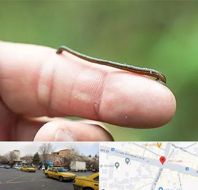 مرکز زالو درمانی در شهناز تبریز