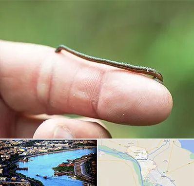 مرکز زالو درمانی در خرمشهر