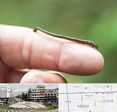 مرکز زالو درمانی در مرکز تهران