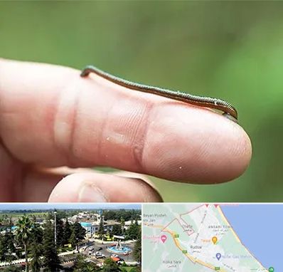 مرکز زالو درمانی در رودسر