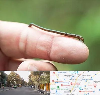 مرکز زالو درمانی در شریعتی