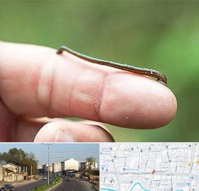 مرکز زالو درمانی در ضیابری رشت