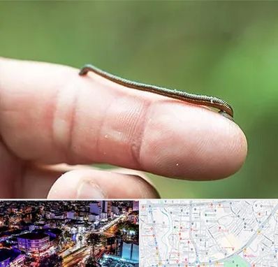 مرکز زالو درمانی در منظریه رشت