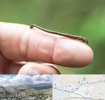 مرکز زالو درمانی در رودهن