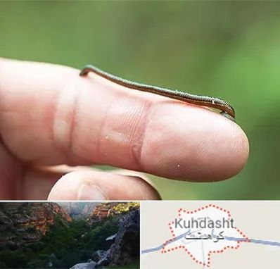 مرکز زالو درمانی در کوهدشت