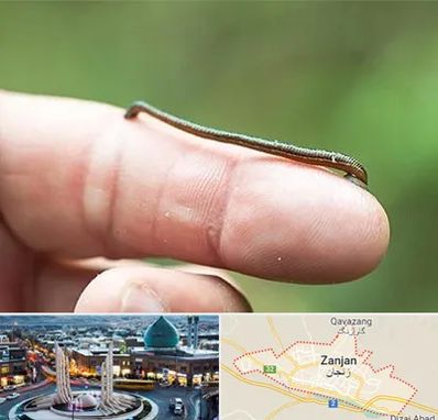 مرکز زالو درمانی در زنجان