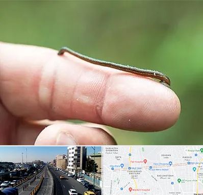 مرکز زالو درمانی در پیروزی