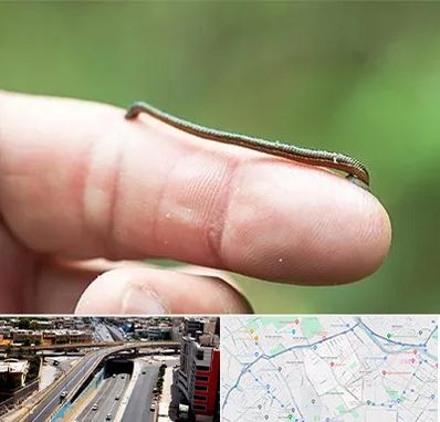 مرکز زالو درمانی در ستارخان شیراز