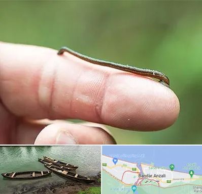 مرکز زالو درمانی در بندر انزلی