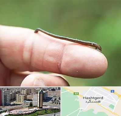 مرکز زالو درمانی در هشتگرد