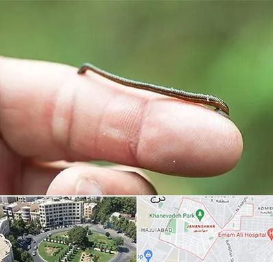 مرکز زالو درمانی در جهانشهر کرج