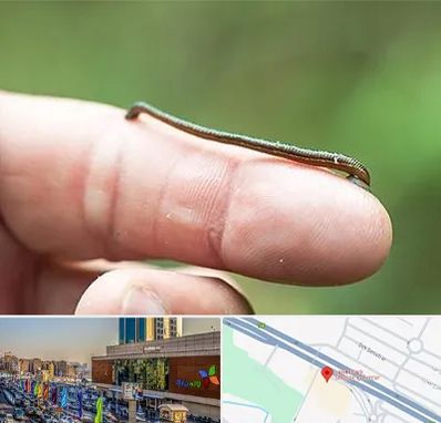 مرکز زالو درمانی در لاله پارک تبریز