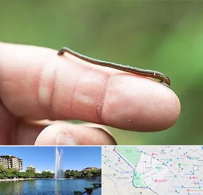 مرکز زالو درمانی در کوهسنگی مشهد