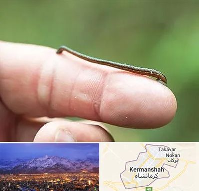 مرکز زالو درمانی در کرمانشاه