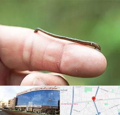 مرکز زالو درمانی در نصف راه تبریز