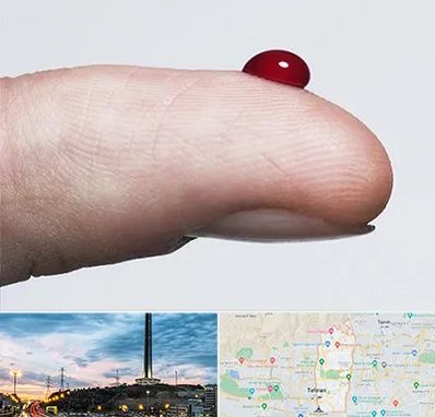 مرکز فصد خون در منطقه 2 تهران