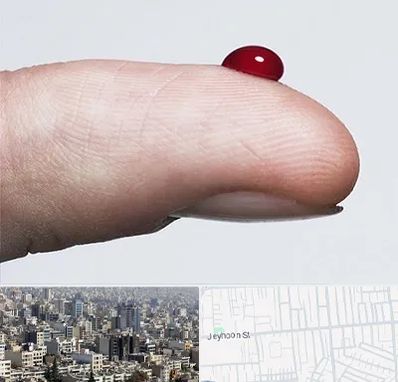 مرکز فصد خون در جیحون