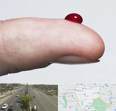 مرکز فصد خون در منطقه 17 تهران