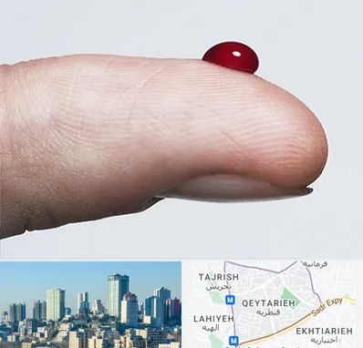 مرکز فصد خون در قیطریه 