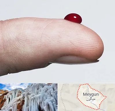 مرکز فصد خون در میگون