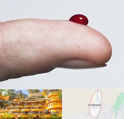 مرکز فصد خون در دربند