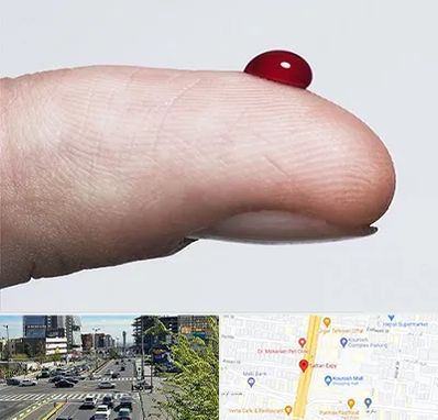 مرکز فصد خون در ستاری