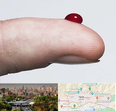 مرکز فصد خون در منطقه 1 تهران