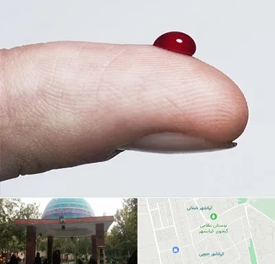 مرکز فصد خون در کیانشهر