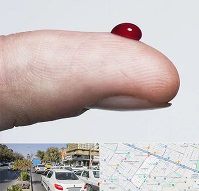 مرکز فصد خون در مفتح مشهد