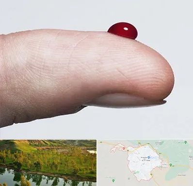 مرکز فصد خون در بهبهان