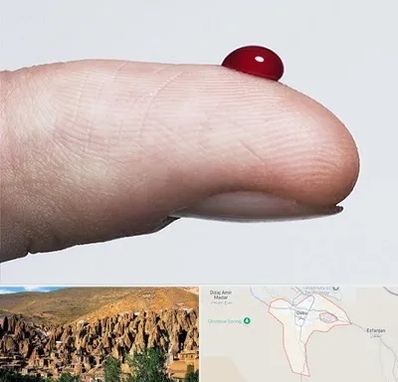 مرکز فصد خون در اسکو