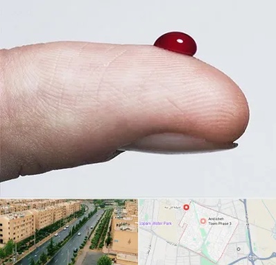 مرکز فصد خون در فاز سه اندیشه