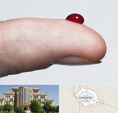 مرکز فصد خون در دهدشت